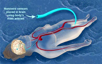 BrainNanowire_f.jpg